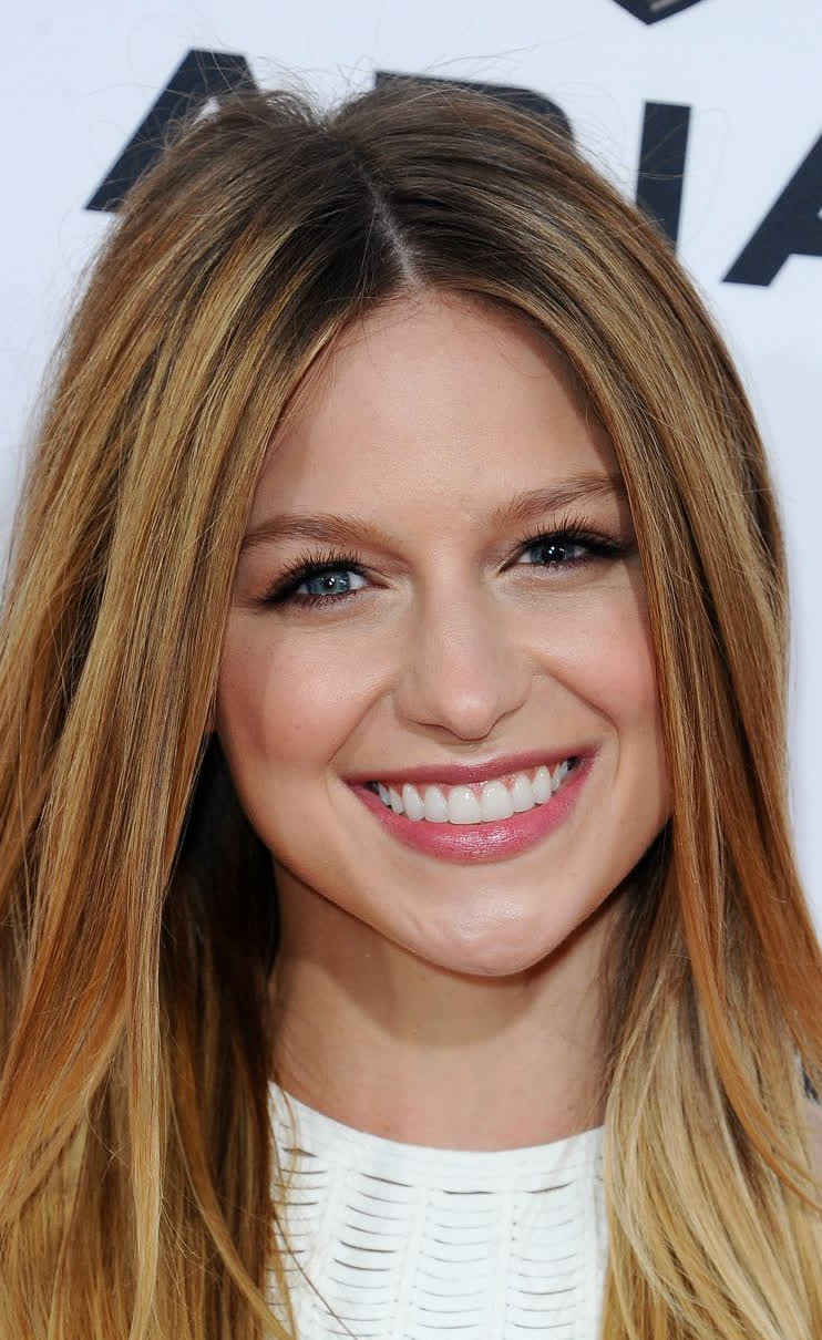 Melissa Benoist Bio Age Height Weight Body Measurements